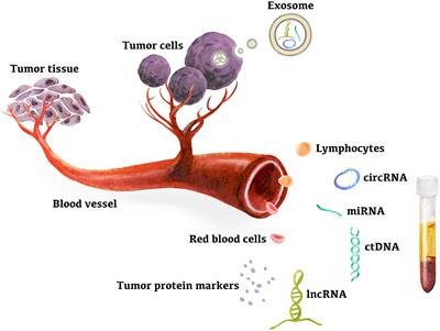 Peripheral Blood Genetic Biomarkers for the Early Diagnosis of Hepatocellular Carcinoma